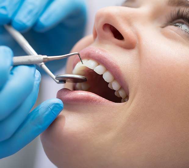 Bayside Dental Bonding