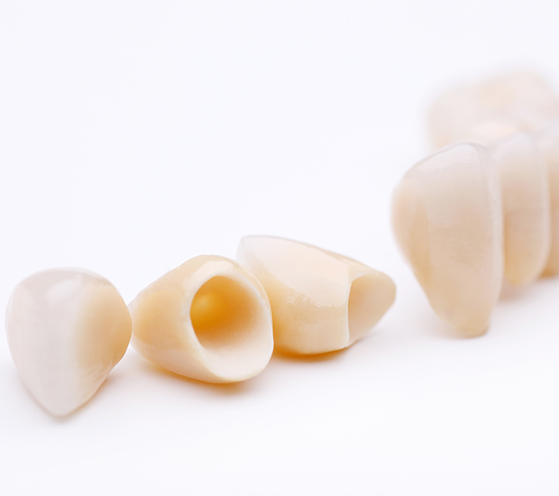 Bayside Dental Crowns and Dental Bridges