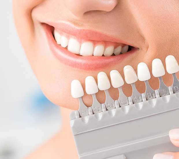 Bayside Dental Veneers and Dental Laminates