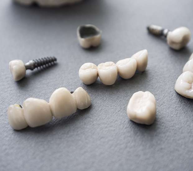 Bayside The Difference Between Dental Implants and Mini Dental Implants
